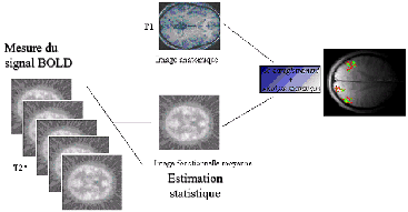 C:\Users\Arnaud\Documents\Mes Dossiers\Useful\Séminaire NeuroLoi - 10-12-2009\Illustrations\image7_article_generalites_irm.jpeg